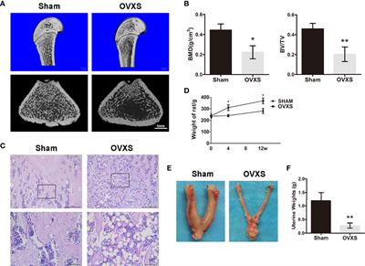 Additive Effect of Parathyroid Hormone and Zoledronate Acid on Prevention Particle Wears-Induced Implant Loosening by Promoting Periprosthetic Bone Architecture and Strength in an Ovariectomized Rat Model